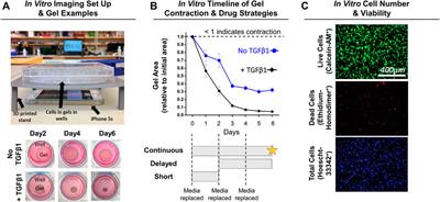 Pleiotropic Effects of Simvastatin and Losartan in Preclinical Models of Post-Traumatic Elbow Contracture